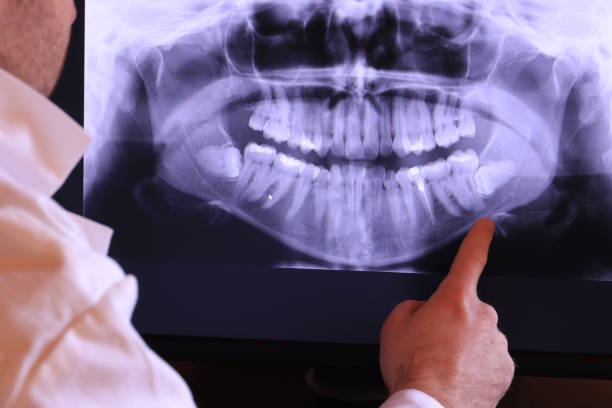 Best Broken or Cracked Tooth Emergency Dentist in Herald, CA