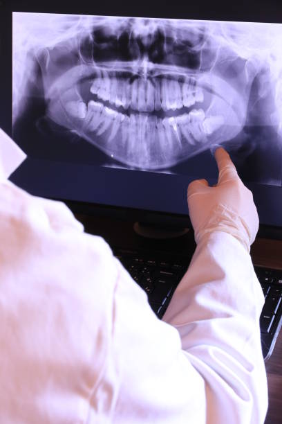 Best Emergency Dentist for Special Needs Patients in Herald, CA